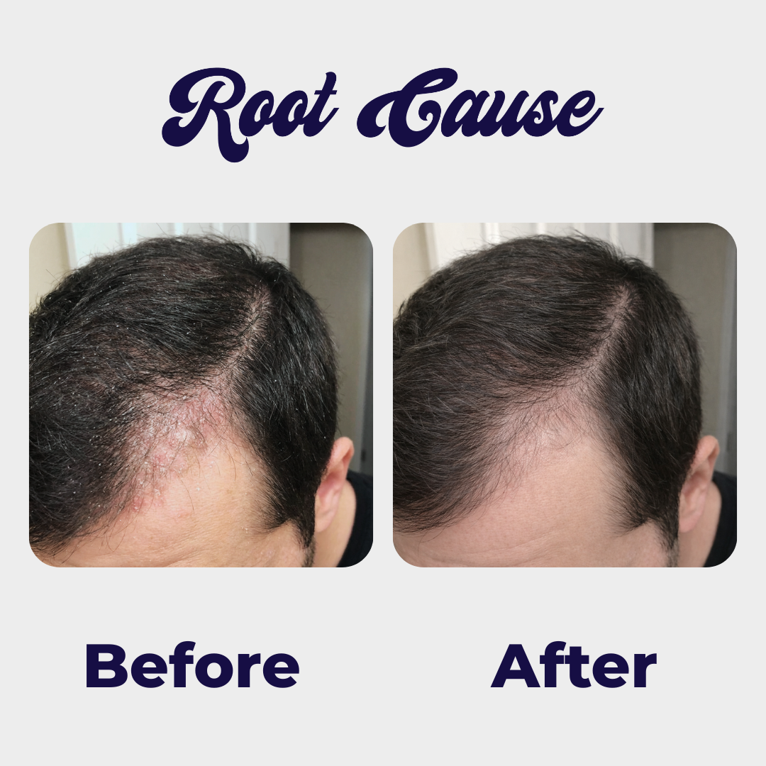 9. Your scalp will be healthy again